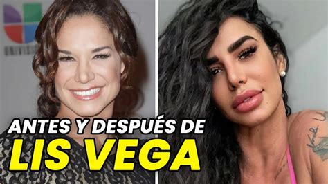 5 FOTOS de Lis Vega que muestran su RADICAL cambio